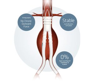 chirurgia vascolare1